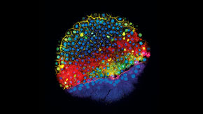 A zebrafish embryo at an early stage of development. Fluorescent markers highlight cells expressing genes involved in determining the type of cell they will become.